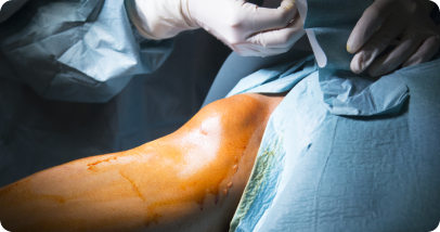 Arthroscopic Surgery