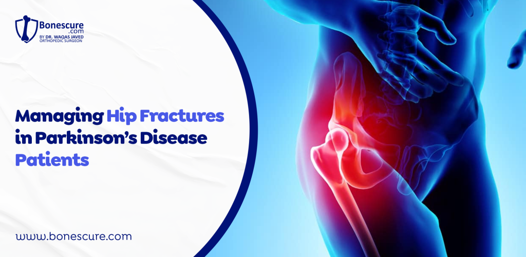 Managing hip fractures