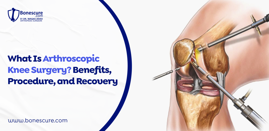 Arthroscopic Knee Surgery