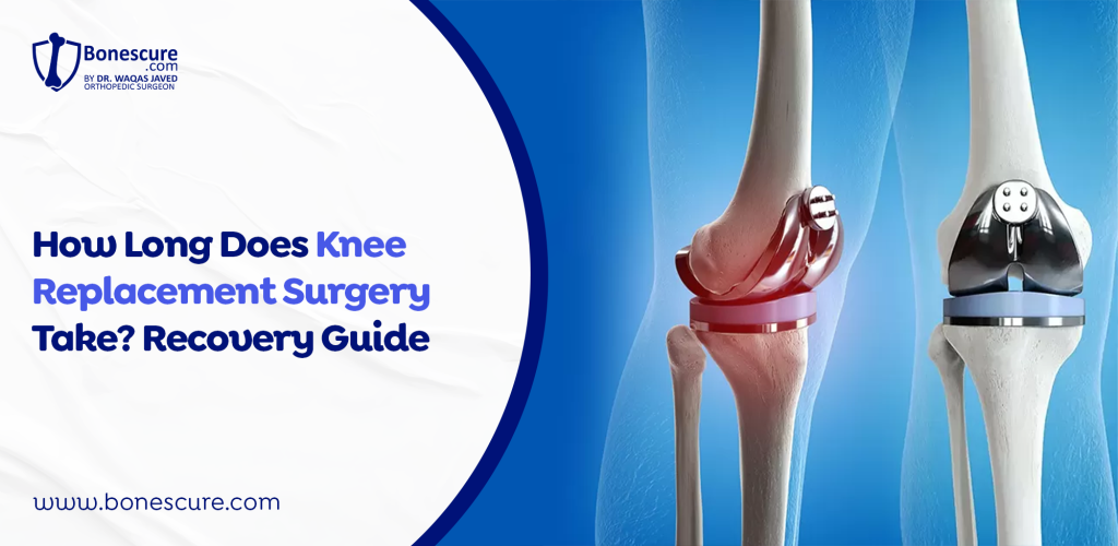 knee replacement surgery